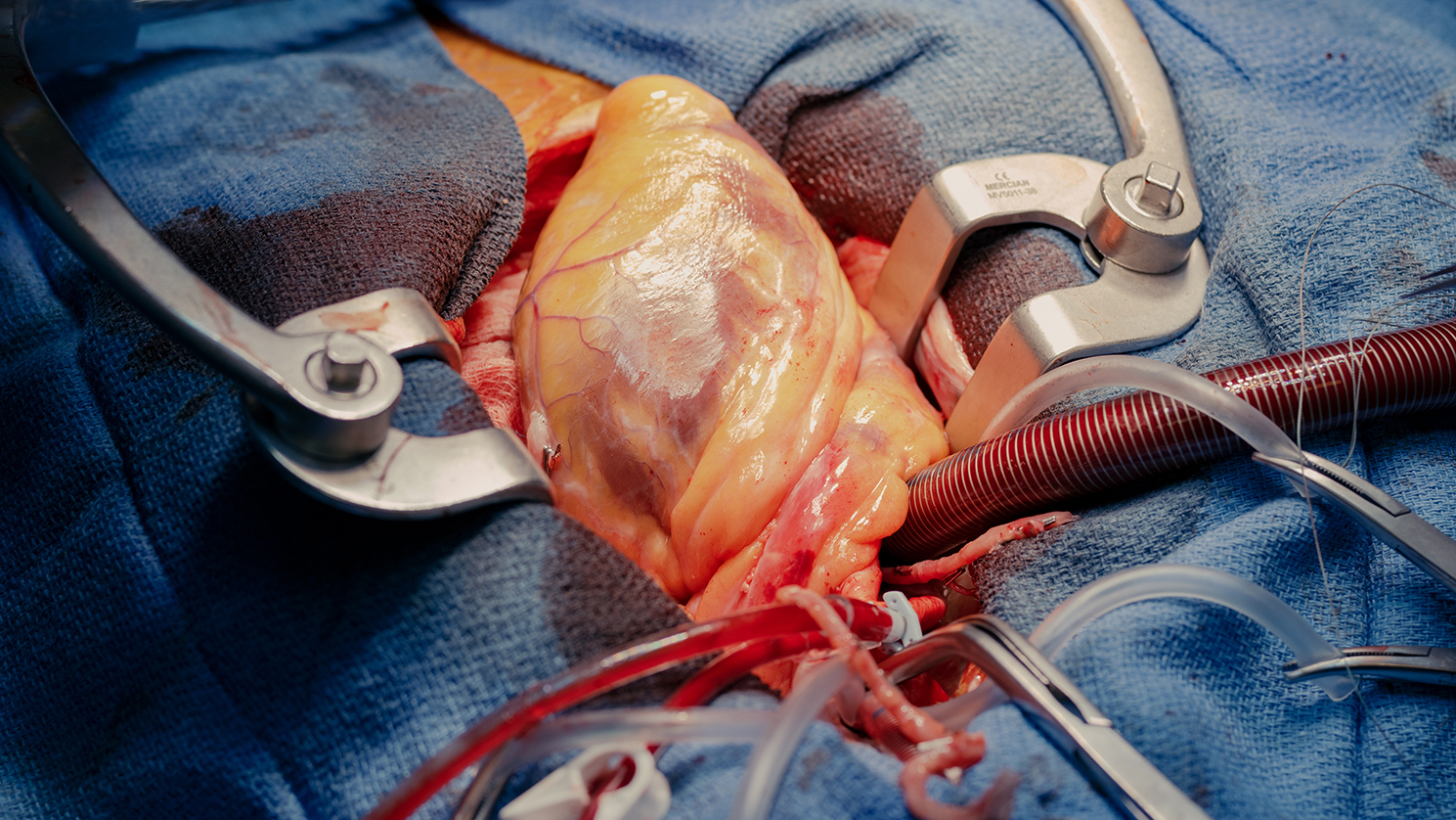 Beste Herzchirurgen in Augsburg